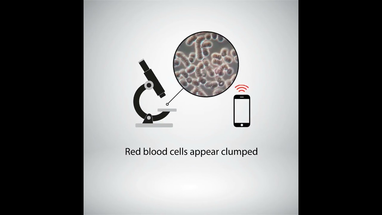 Visually see products working.  Blood Microscopy Testing of products from EMF Solutions. 24 sec
